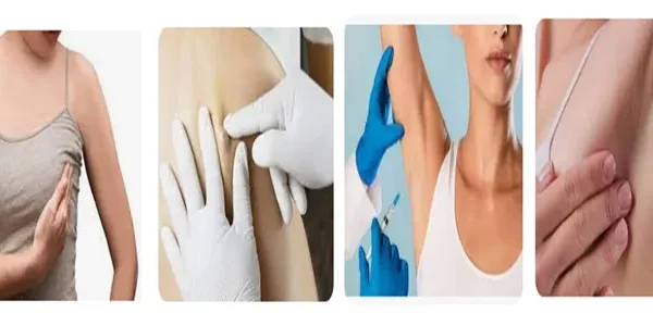 Managing Non-Harmful Armpit Lumps: When to Seek Medical Intervention