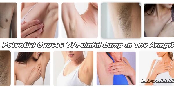 Potential causes of painful lump in the armpit